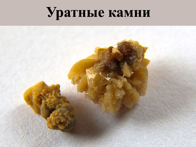 Разновидность камней 