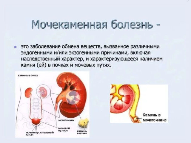 Схематический рисунок 