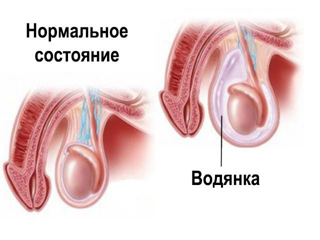 Схематический рисунок 
