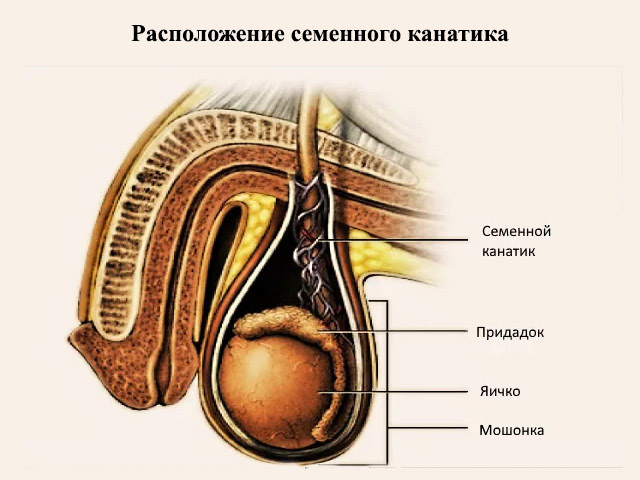 Схематический рисунок 