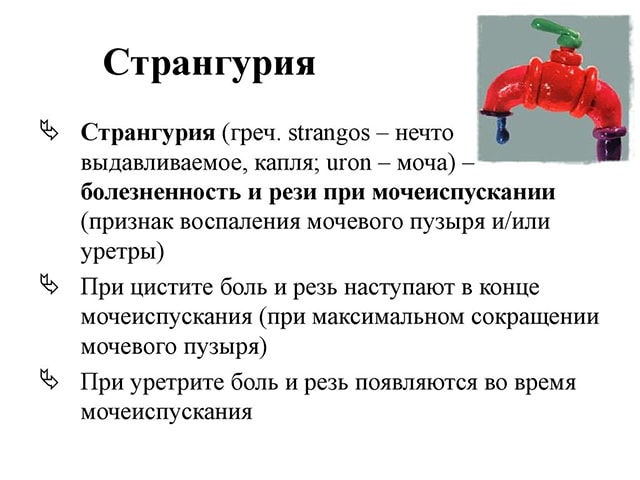 Странгурия