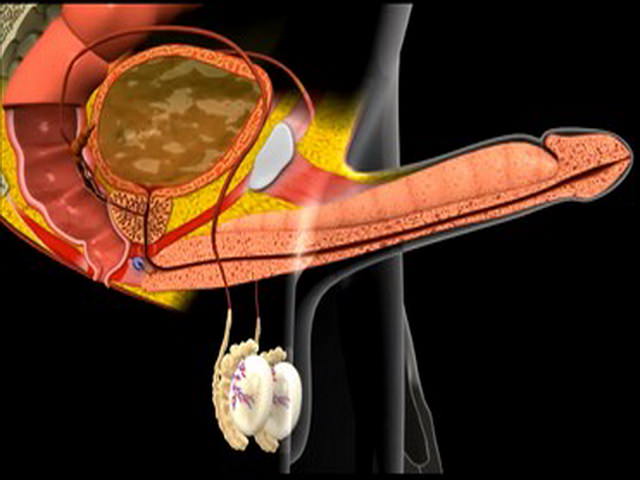 Трехмерный рисунок 