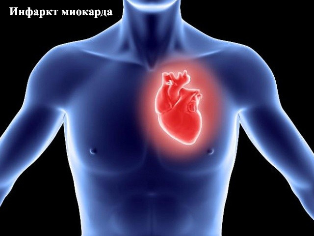 Трехмерный рисунок 