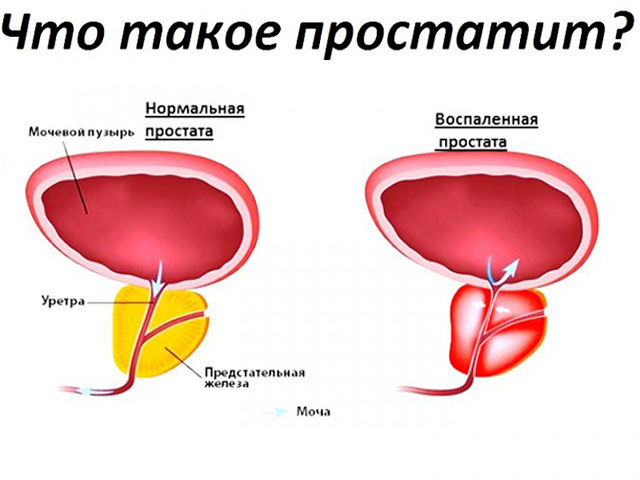 Схематический рисунок