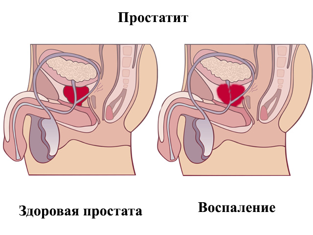 Схематический рисунок 