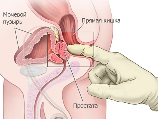 Схематический рисунок 