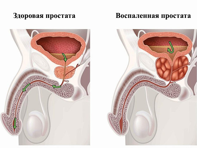 Схематический рисунок 