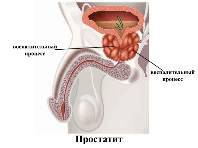 Схематический рисунок 