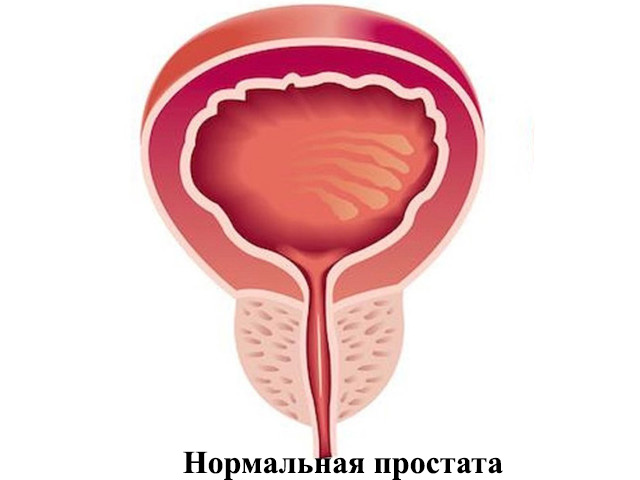 В пределах нормы Схематический рисунок