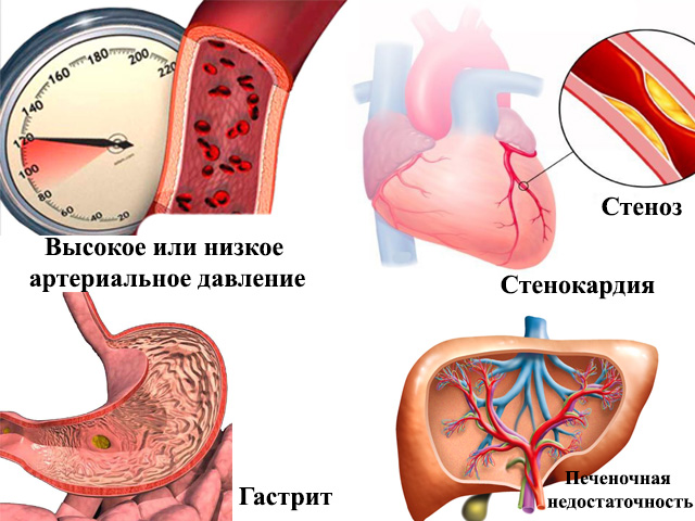 Схематический рисунок 