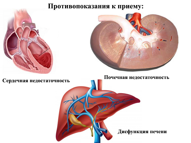 Противопоказания к применению препарата Схематический рисунок