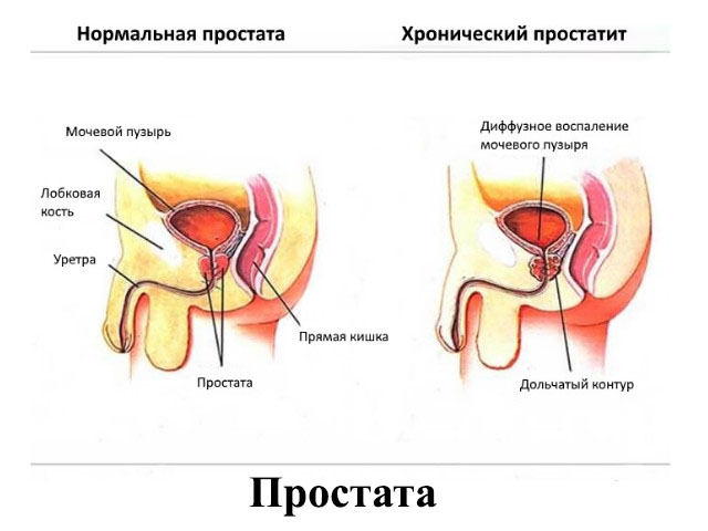 Схематический рисунок 