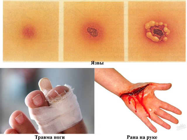 Рекомендации к применению Сборный рисунок