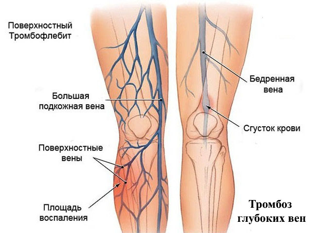 Схематический рисунок 