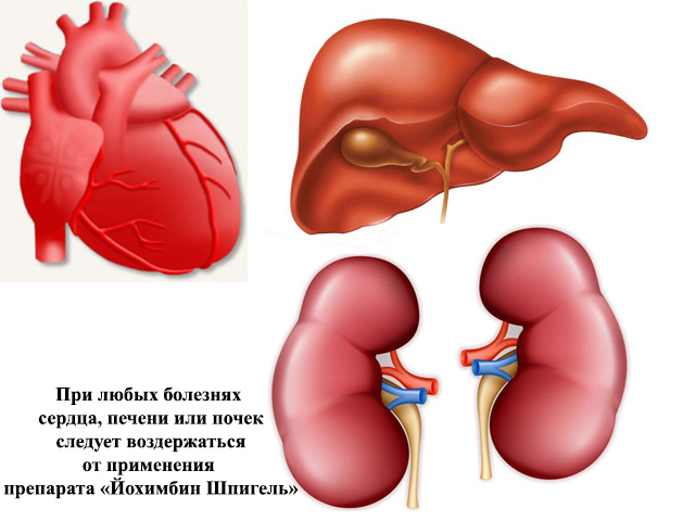 Схематический рисунок 