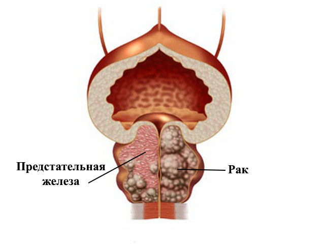 Схематический рисунок 
