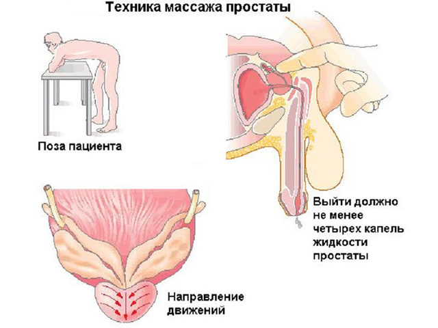 Схематический рисунок 