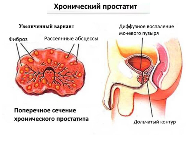 Схематический рисунок 