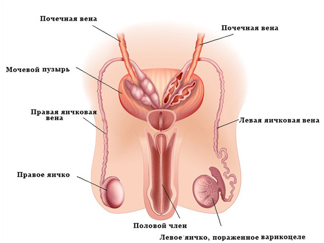 Схематический рисунок 