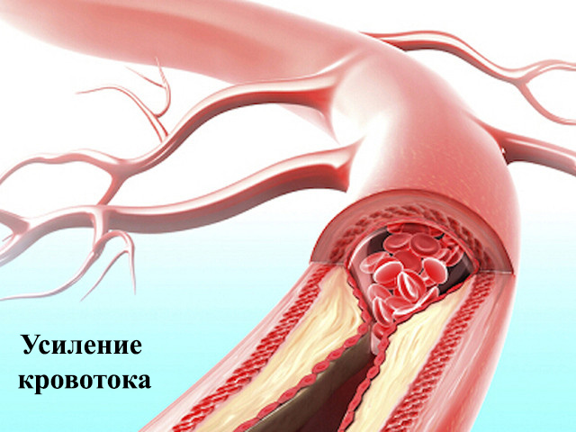 Трехмерная модель сосуда 