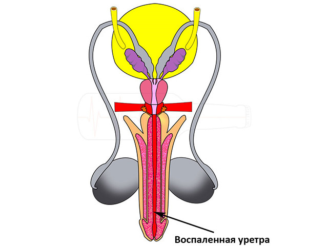 Схематический рисунок 