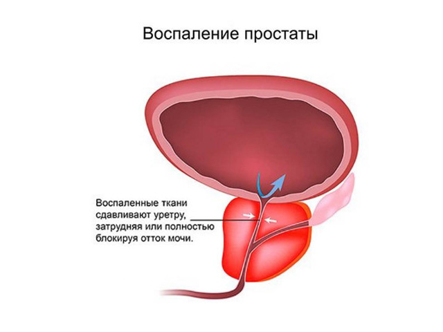 Схематический рисунок 