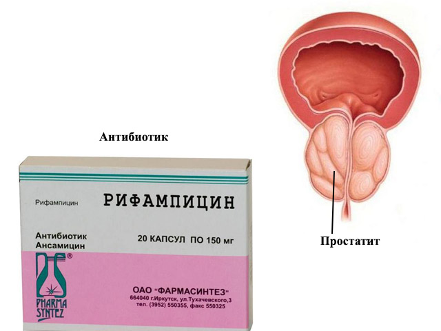 Лечение сильными средствами 