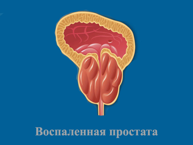 Схематический рисунок 