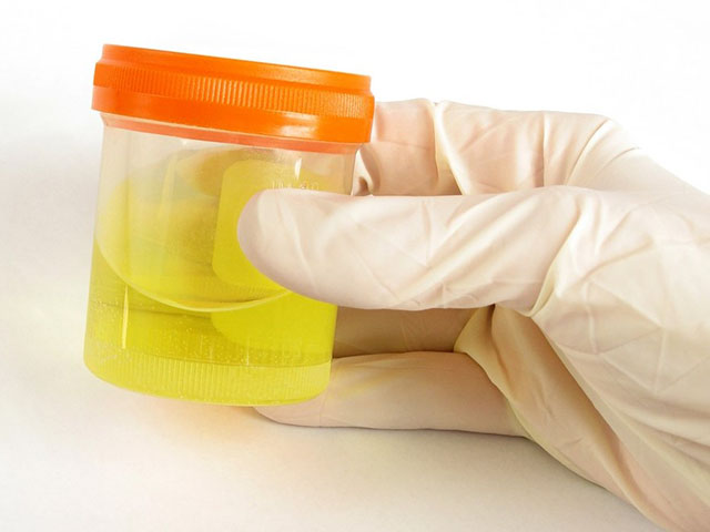 Сдаем анализы