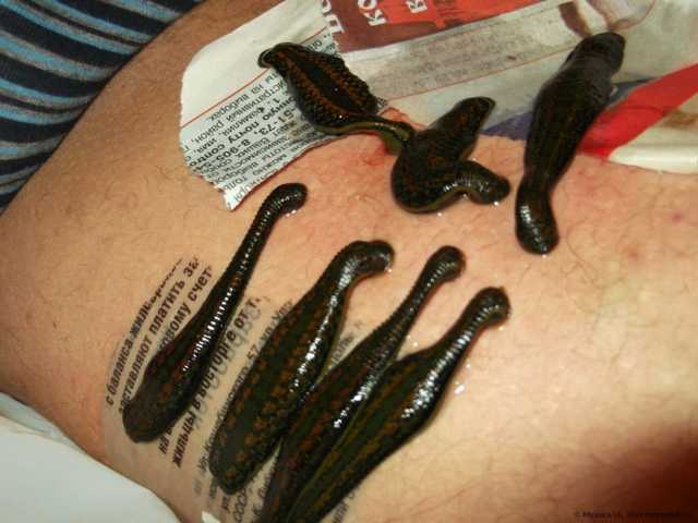 Метод терапии