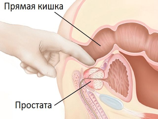 Массаж простаты самому себе
