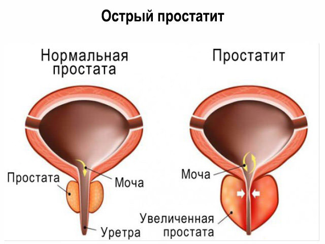Показания к применению