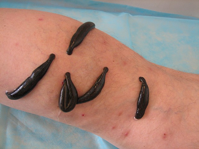 Местное применение