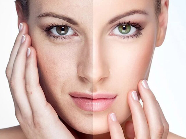 Чистая кожа