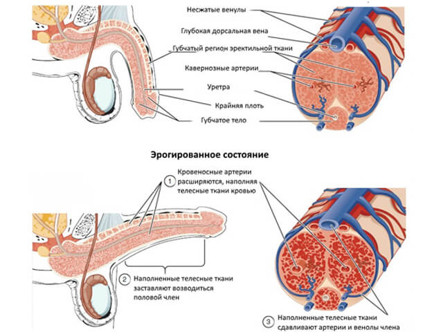 Эрекция