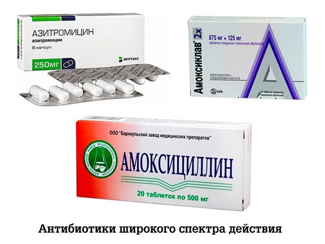 Антибиотики широкого спектра
