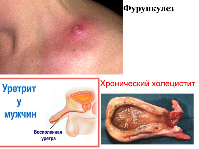 Различные заболевания 