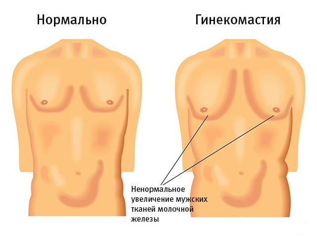 Схематический рисунок