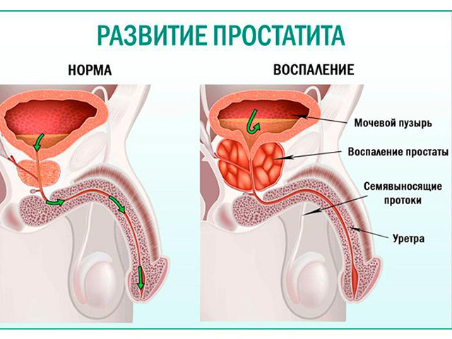 Схематический рисунок 