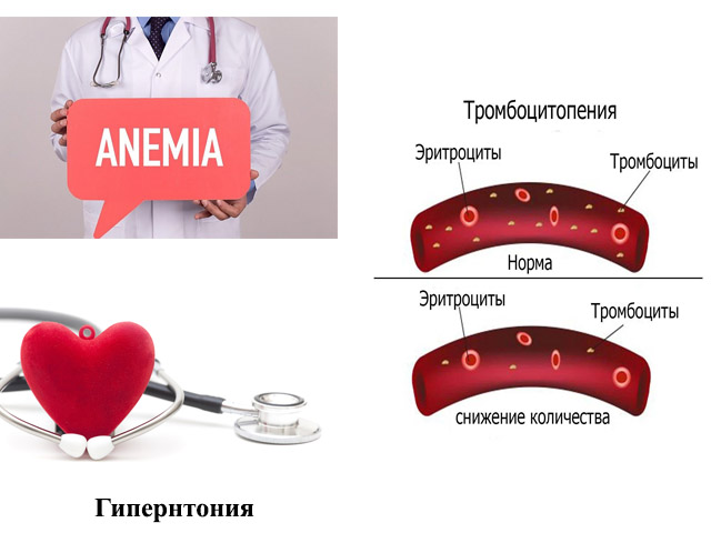 Противопоказания для приема препарата 