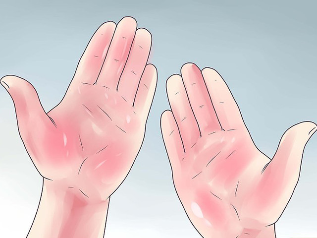 Покраснение и зуд на коже 