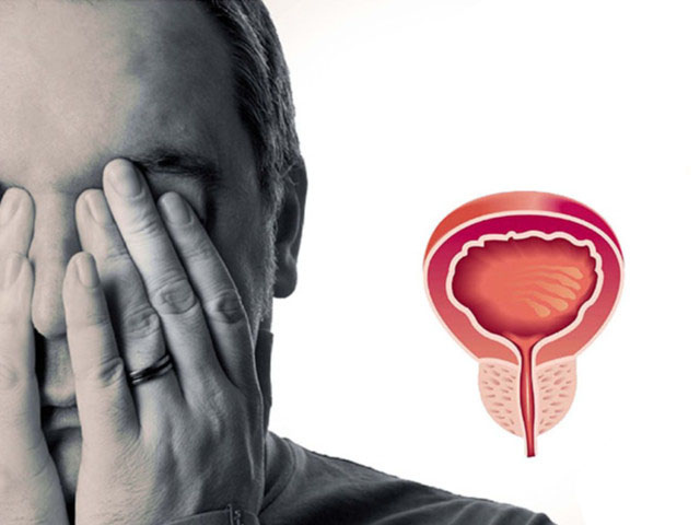 Мужская проблема