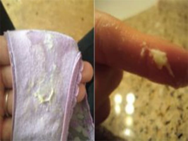 Осложнение заболевание Осложнение