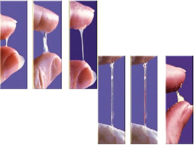 Виды выделений 