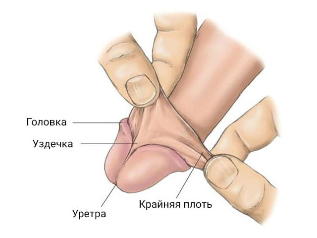 Схематический рисунок