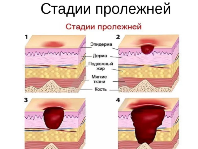 Схематический рисунок 