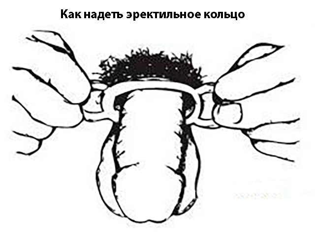 Схематический рисунок