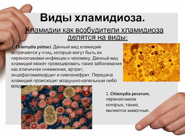 Виды хламидиоза Сборный рисунок