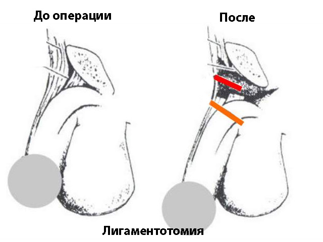 Схематический рисунок