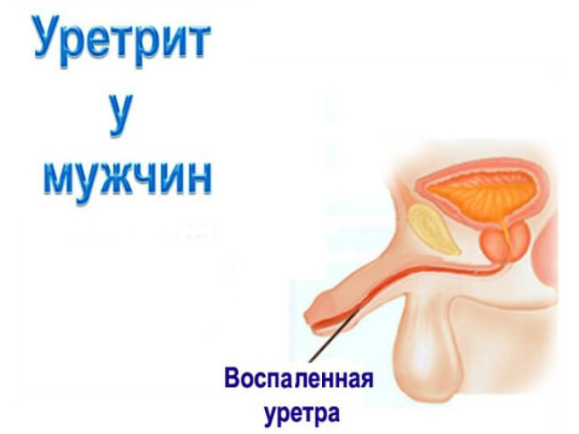 Схематический рисунок